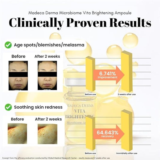 MADECA DERMA Vita Brightening Microbiome Ampoule – Brightening with Vitamins C & E, Hyaluronic Acid & Antioxidants, Korean Skincare for Radiant, Even Tone & Dark Spot Care (0.23 fl oz x 5 Bottles)