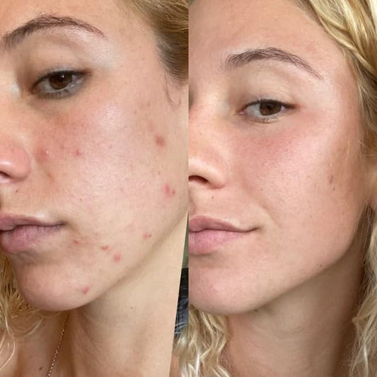 Gin Amber Beauty - Retinol 2.5% Serum - Anti-aging | Brighthening, Plant Based Retinol Serum (1 fl oz - 30 ml)