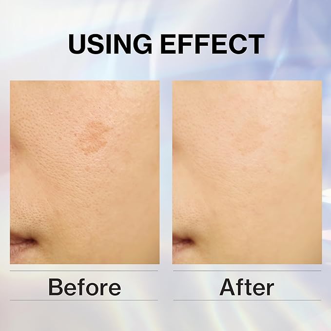 Japanese Facial Softening Toner, Water-Based, Hydrating, Smooth Skin, Cherry Blossom Sakura Extract, Vitamin C, AHA, “Kuramoto-no-Shizuku”, Paraben Free, Cruelty Free(1 Month 5.07 fl oz)