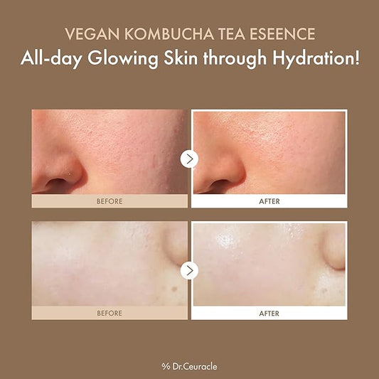 Dr.Ceuracle Vegan Kombucha Tea Essence - Hydrating Milky Toner with Kombucha Tea Extract, Centella Asiatica, Ceramide, Korean Skincare (150 ml / 5.07 fl. oz.)