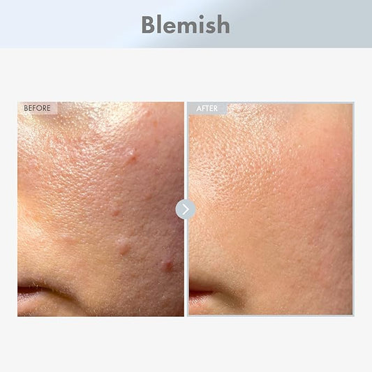 Niacinamide 15% Face Serum, 150,100ppm Niacinamide, Tranexamic acid, Dark Spot Corrector, Glass Skin, Radiant Complexion, Pore Minimizer, Even Skin Tone, Korean Skin Care, 30ml, 1.01 fl.oz.