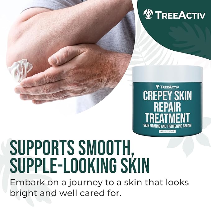 TreeActiv Crepey Skin Repair Treatment, 8oz, Firming Cream with Hyaluronic Acid & Shea Butter to Deeply Moisturize & Tighten Wrinkly Dry Crepe Skin, 500+ Uses