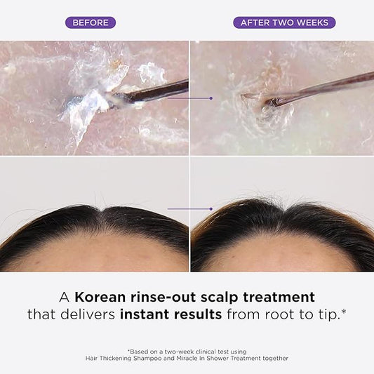 Dr. Groot Miracle in Shower Treatment, Korean Hair Care, 5 Seconds to Smooth Hair, Rosemary Oil for Healthier-Looking Hair, Hair Rinse, Moisturizing Hair Treatment, Kbeauty Scalp Revitalizing Solution