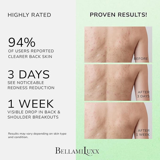 Back and Body Acne Treatment Spray: 2% Salicylic Acid & Tea Tree Oil Bacne Spray for Clear, Soothe & Moisturize - Effective for Men, Women, Teens with Back, Shoulder, Arm, and Chest Acne