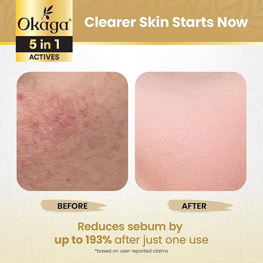 White Rice Peel Shot Ampoule, White Rice Exfoliant, Rice Exfoliator for Face & Soft Peel, Removes Dead Skin Cells for a Brighter, Softer & Hydrated Complexion, For All Skin Types, 90 mL