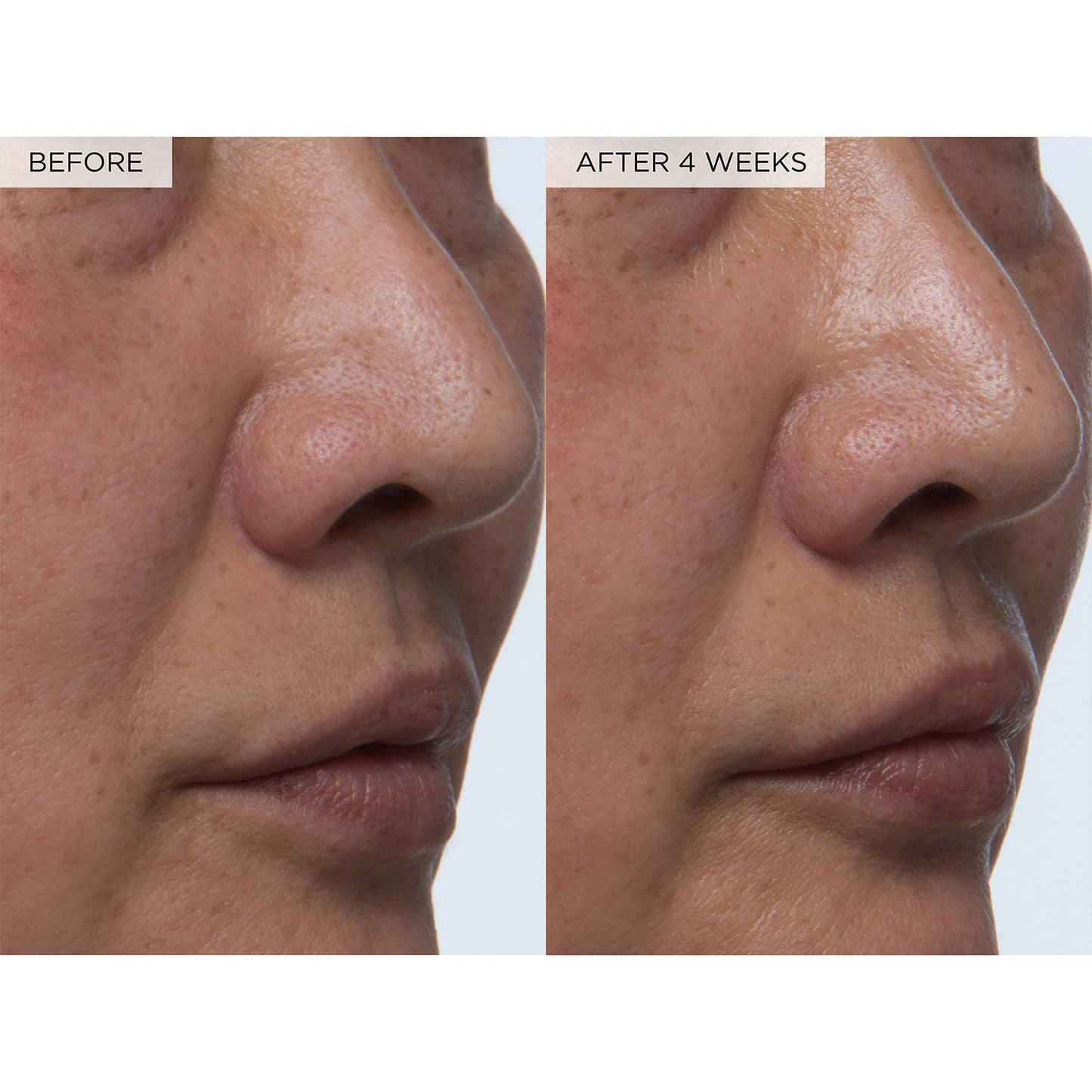 PHA + BHA Face Toner - Korean Skin Care Pore Minimizer & Gentle Facial Exfoliator for Tightening, Hydrating & Exfoliating - Glycerin, Watermelon & Cactus Water (150Ml)