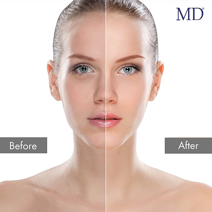 MD Enzyme Peeling Mask