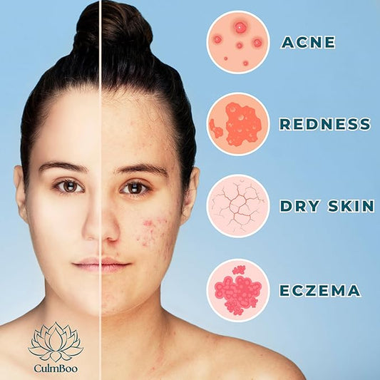 Hypochlorous Acid Spray for Face & Skin - HOCl, Acne Prone Skin, Eczema, Natural Tattoo Aftercare, Piercing Aftercare Spray, Eye Lash Cleanser, Face Mist Toner, Wound Care Cleanser, 8 Fl Oz