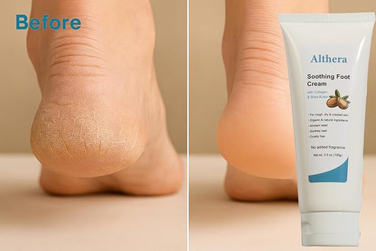 soothing Foot Cream with Collagen, Lactic Acid & Shea Butter – 3.5oz Intensive Repair for Dry Cracked Heels, Includes Moisturizing Sock for Overnight Hydration (full sock)