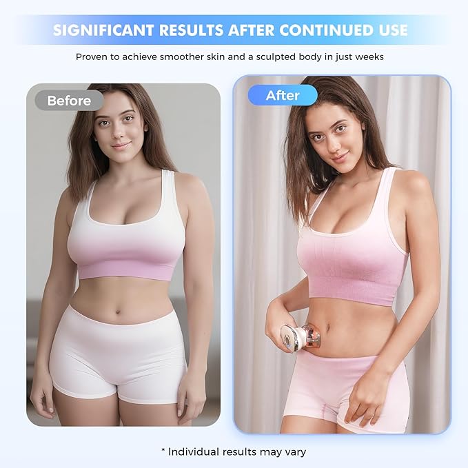 REDLOOK 3-in-1 Body Sculptor - Body Sculpting Massager for Stomach, Arms, Legs, & Love Handles - Anti Cellulite Massage Tool, Cellulite Remover, Lymph Drainage Machine, & Skin Tightening Device.