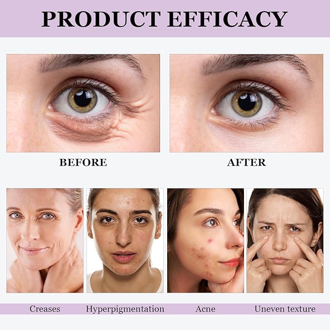 Venature Bakuchiol Retinol Serum, Retinol & Vitamin for Wrinkles Bakuchiol Face Serum Korean (2Pcs)