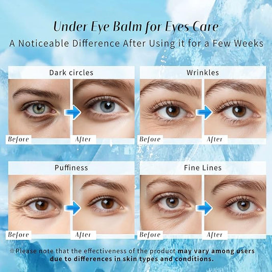 Eye Balm for Dark Circles: Cooling Eye Cream Under Eye Treatment, Cool Eye Stick Reduce Wrinkle & Puffiness, Hydrating Balm for Eye Bags Skin Care
