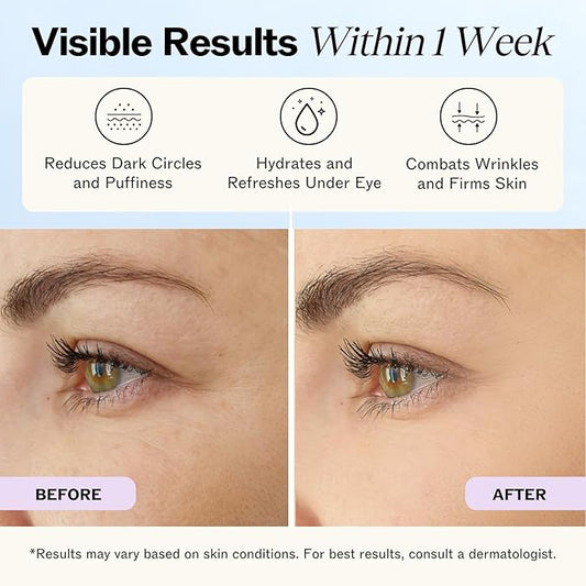 LilyAna Naturals Eye Cream for Dark Circles and Puffiness, Under Eye Cream for Wrinkles and Bags, Anti Aging - helps Improve Dryness; for Sensitive Skin - 1.7 oz - Made in USA