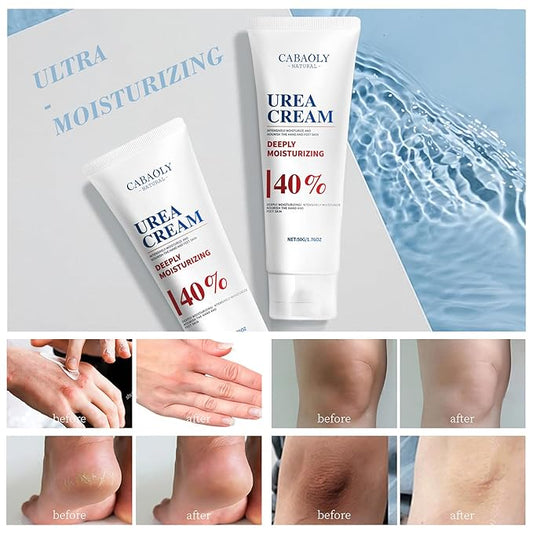 Urea Cream 40% is suitable for the repair and care of dry and cracked feet, heels, knees, elbows and hands. Portable hand cream with moisturizing properties