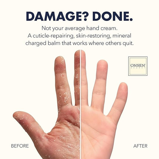 Onsen Nail & Cuticle Rescue Kit - Conditioner Serum, Repair Oil & Cuticle Balm - Tsubaki, Shea Butter, Jojoba - Strengthens Nails, Softens Cuticles, Hydrates Skin (15ml Serum + 10ml Oil + 26ml Cream)