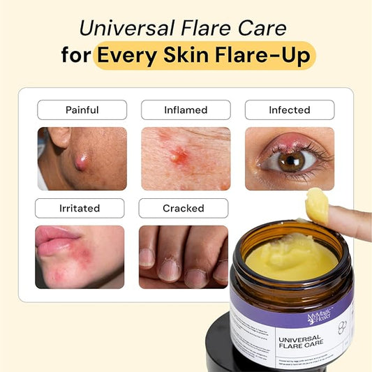 Universal Flare Care | Drawing Salve for HS, Boils, Cysts, Hemorrhoids, Pilonidal Cyst, Abscess | Anti-Chafing, Wound Care, Relief for Itching Skin w/Propolis & Egg Yolk Extract 2 oz