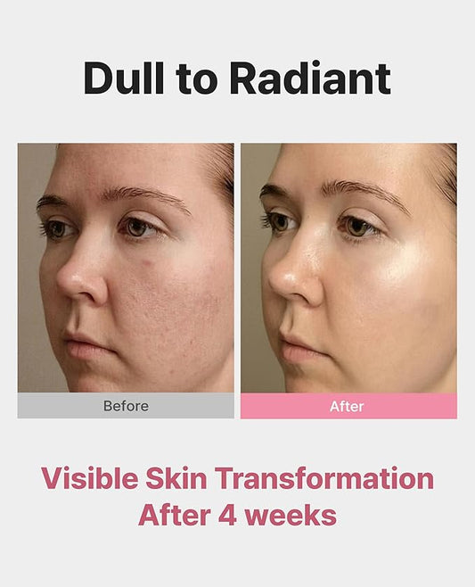 Delere Caviar AHA 3% Glow Toner | Korean Collagen Exfoliating Toner | Korean Exfoliator for Radiance, Collagen Skin Care, 250ml