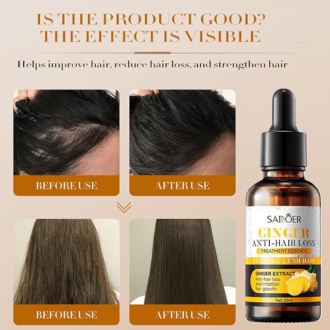 2 PCS Ginger Hair Treatment Oil, Hair Repair and Growth Serum for Dry, Damaged & Coarse Hair, Hair Essential Oil for All Hair Types, 1 Fl. Oz Each