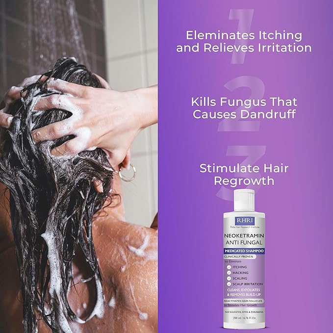 Anti Fungal Shampoo for Men & Women | Anti Dandruff, Medicated, Folliculitis Shampoo for Dry Scalp, Psoriasis, Ringworm | for Itchy, Flaky & Irritated Scalp | No Paraben & Sulphate