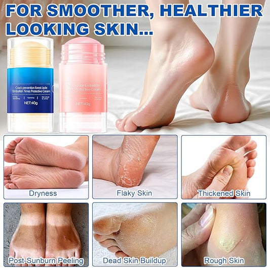 Crack Feet Prevention Stick, Urea Cream 60%, Anti Crack Foot Cream Stick, Strength Moisturizer Foot Lotion stick, Softening and Nourishing Cream, for Dry, Cracked Heels & Thickened Skin (Pink+Blue)