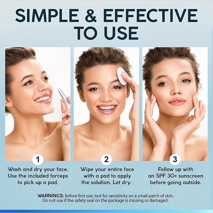 NUVADERMIS 35% Glycolic Acid Peel Pads – Exfoliating Facial Resurfacing for Blackheads, Dark Spots, and Acne – Safe for Sensitive Skin – 60 Double-Sided Pads