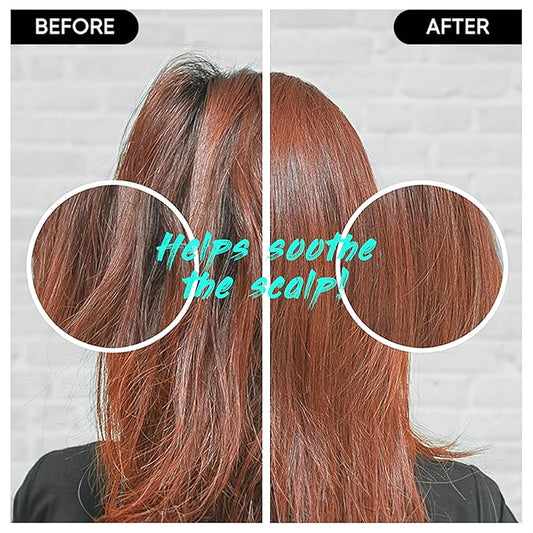 Centella Shampoo Bar 2.0 - Hydrating & Moisturizing Natural Hair Soap Bar Shampoo for Hair & Scalp Nourishment - Bathing Soap Solid Shampoo for All Hair Types (120g, 4.23oz)