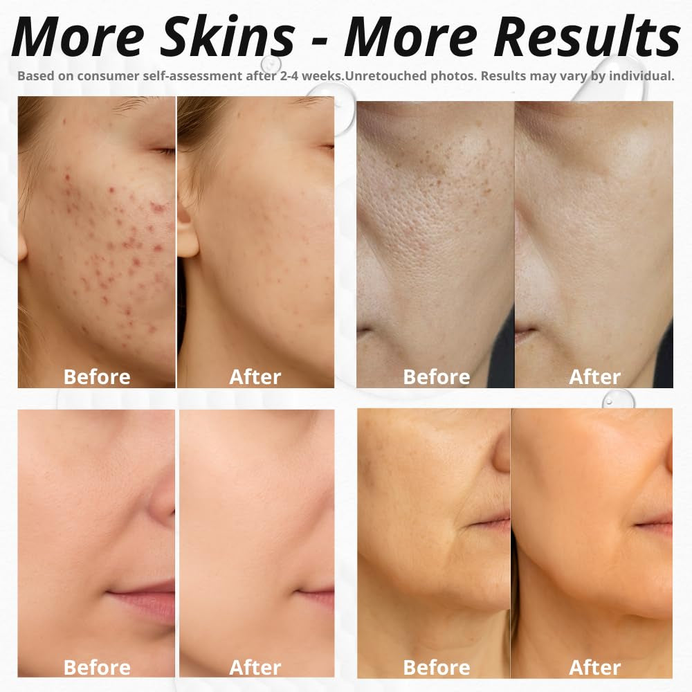 Glycolic Acid Pads for Face – Exfoliating Toner Pads with Salicylic Acid, Alpha Arbutin, Vitamin B3 B5 B8 – Daily Facial Radiance Pad for Smooth Texture, Clear & Blemish-Free Skin – 70 Count