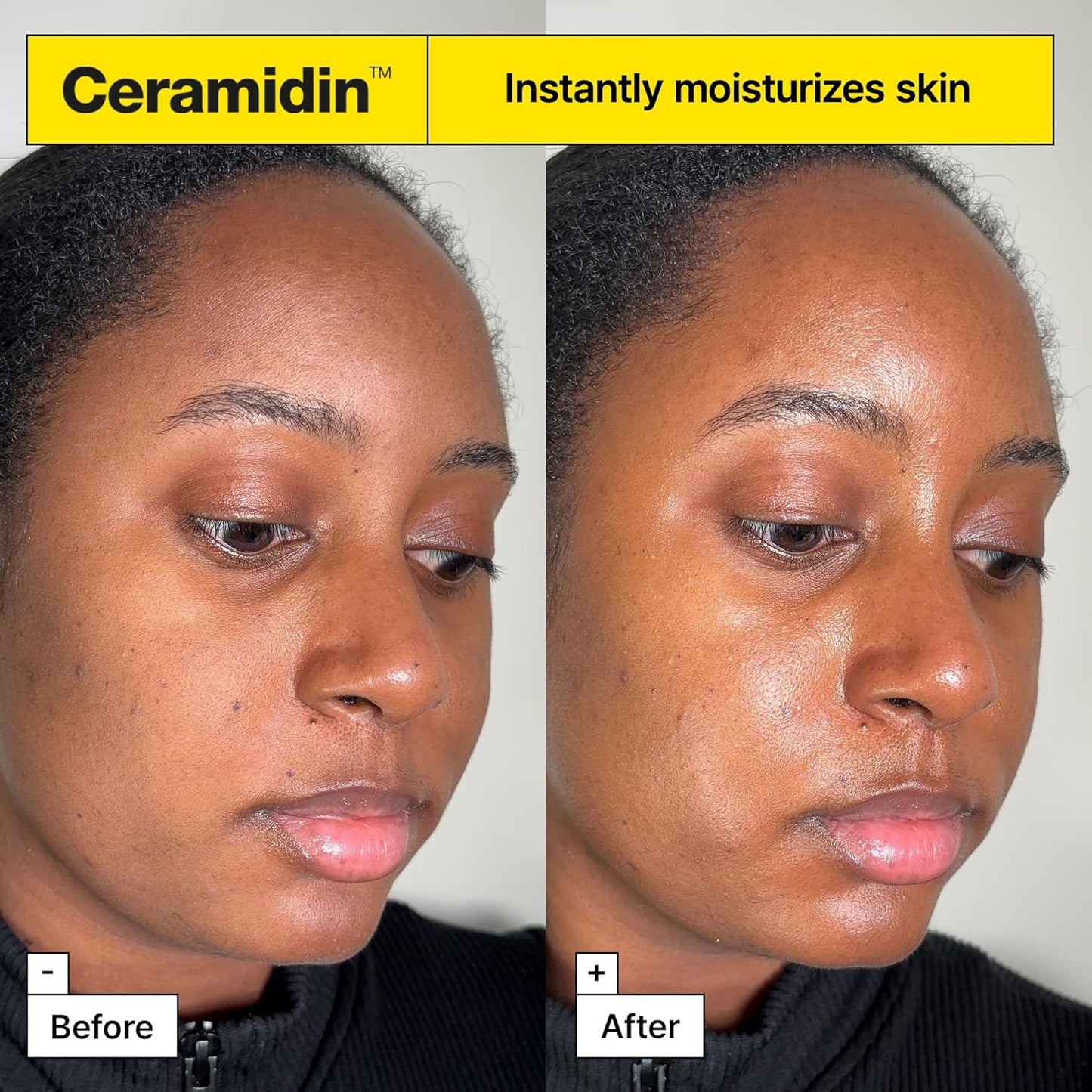 ✨ Ceramidin Moisture Face Cream