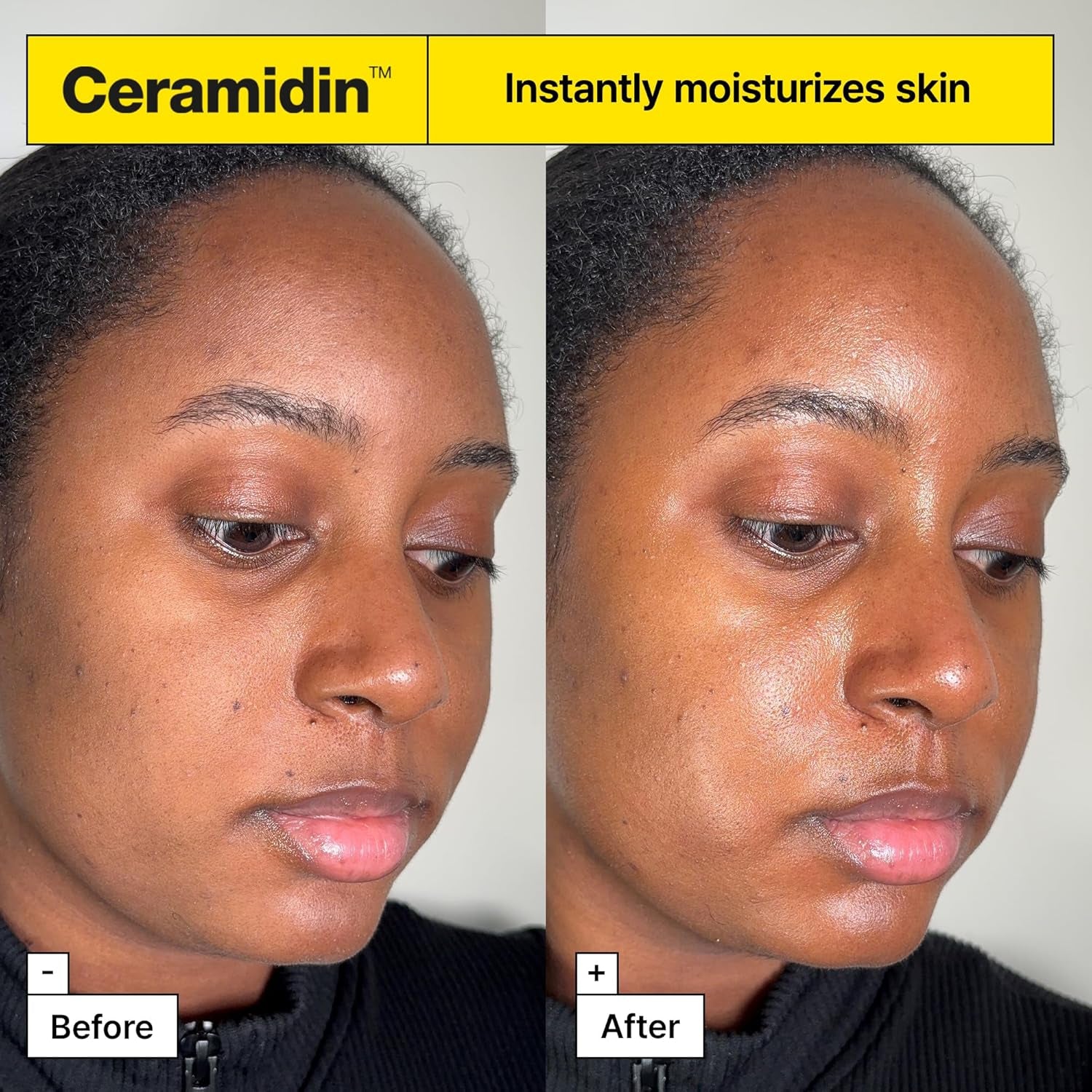 ✨ Ceramidin Moisture Face Cream