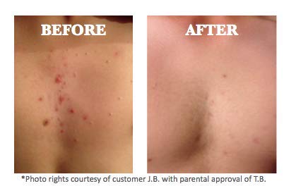 CreekBaby Organic Sea Salt Spray for Face, Body, and Hair, Toner for Acne, Rosacea and Hair Volumizer