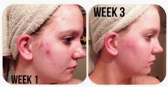 CreekBaby Organic Sea Salt Spray for Face, Body, and Hair, Toner for Acne, Rosacea and Hair Volumizer