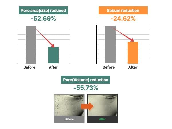 S. Nature AQUA SQUALANE MOISTURIZING CREAM | Face Moisturizer for Dry and Sensitive Skin, Vegetable Squalane 150,00ppm, Long-lasting Hydration, Pore Care Cream, Korean Skin Care (2.02 Fl Oz, 60ml)