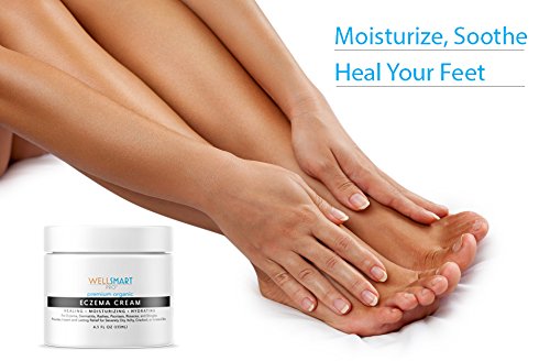 Eczema Foot Cream – Foot Eczema Treatment for Cracked Heels, Dry Feet and Rash Relief – Organic, Fragrance-Free, Hypoallergenic – Soothes Eczema, Psoriasis, Dermatitis – 4.5 oz