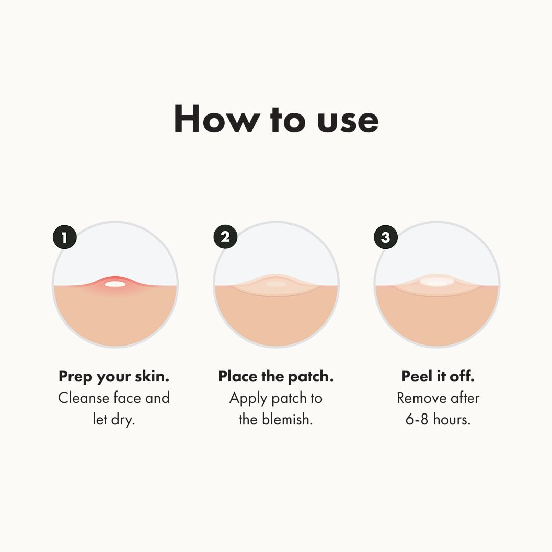 ™ Original Patch from Hero Cosmetics – the #1 Hydrocolloid Acne Pimple Patch for Shrinking Zits and Whiteheads in 1 Use; Nighttime Spot Stickers for Face and Skin (36 Count)