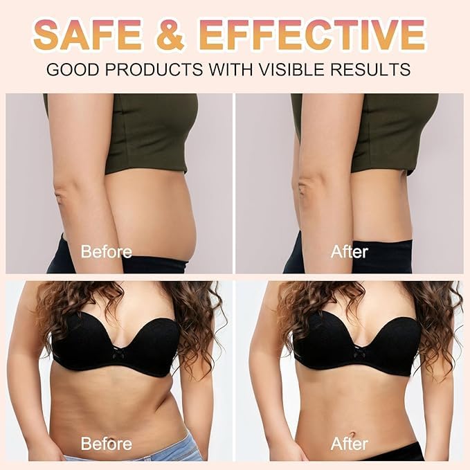 OFOBC B Flat Belly Firming Cream – B Flat Skin Tightening & Toning for Stomach, Waist & Hips, Reduces Cellulite Appearance, Improves Elasticity – All Skin Types (3.52 Fl. OZ).