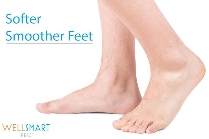 Eczema Foot Cream – Foot Eczema Treatment for Cracked Heels, Dry Feet and Rash Relief – Organic, Fragrance-Free, Hypoallergenic – Soothes Eczema, Psoriasis, Dermatitis – 4.5 oz