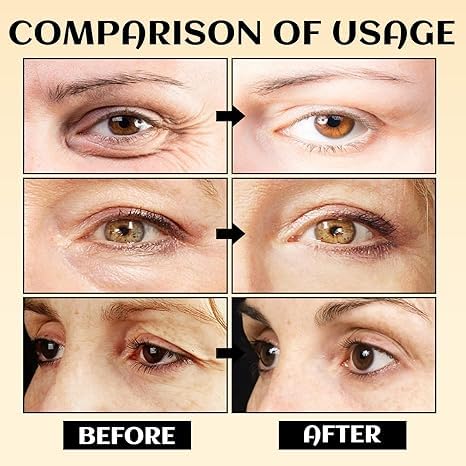 2PCS Turmeric Eyes Cream for Under Eye Bags, 2025 New Turmeric Cream Erases Eye Bags Within Minutes, Moisturizing Under Eyes Balm for Travel Care Serum for Women