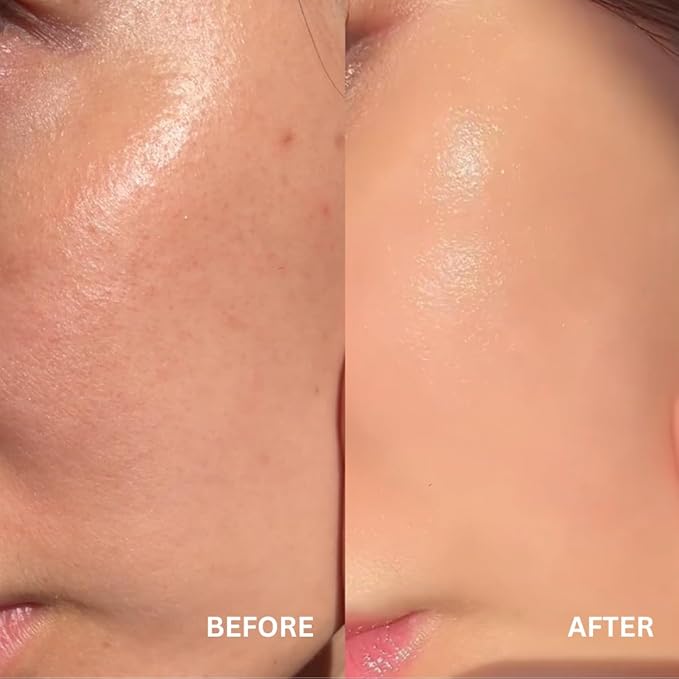 Korean Stem Cell + Toner Serum w/Moroccan Argan Tree Stem Cells, Hyaluronic Acid & Antioxidants, Firming, Hydrating, Anti-Aging, Boosts Collagen Production, Cooling w/Aloe Vera