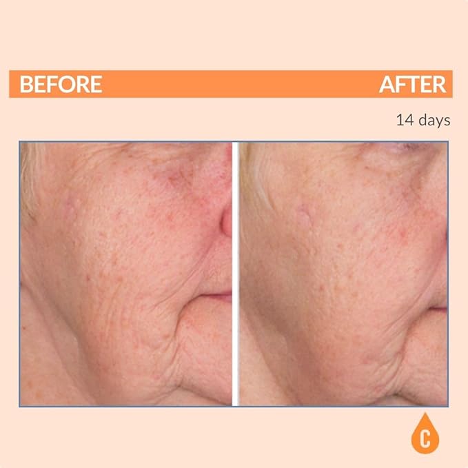 Serious Skincare - Vitamin C Broad Spectrum SPF 30 Sunscreen Moisturizer for Face, Hydrates Dry Skin, C3 Esters Anti-Aging Wrinkle Cream with Collagen, Radiant Skin, Daily Use, No White Cast 2 Fl. Oz.