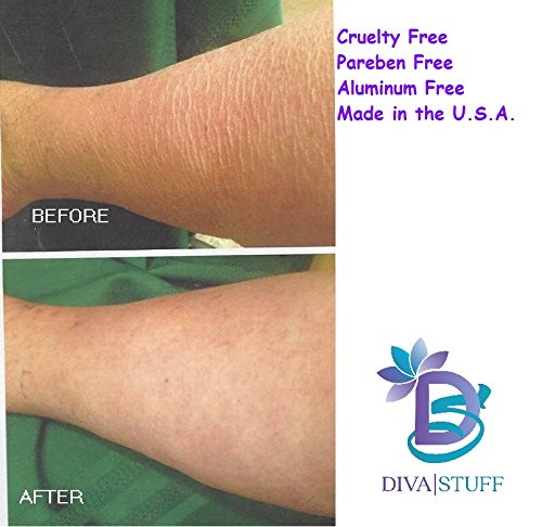 Diva Stuff Crepey Skin Body & Face Cream With Hyaluronic Acid, Alpha Hydroxy and More (blushed orchid scent)