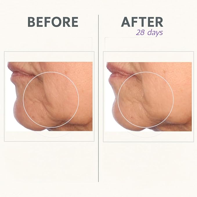 Serious Skincare Reverse Lift Cream In-Tense, Facial Moisturizer for Lifting & Firming, Day and Night, Hydrating, Anti-Aging Skin Care, Peptides, Face Tightening Plant Extracts 1.7 oz