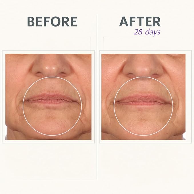 Serious Skincare Reverse Lift Cream In-Tense, Facial Moisturizer for Lifting & Firming, Day and Night, Hydrating, Anti-Aging Skin Care, Peptides, Face Tightening Plant Extracts 1.7 oz