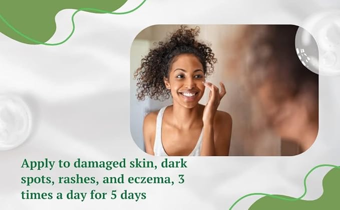 Aloe Vera Cream, Correct Dark Marks, Dry Skin and New Scars on Body, Face Cream for Blemishes, Reduce Appearance of Scars from Acne, Dark Spot Remover For Men, Women and Kid