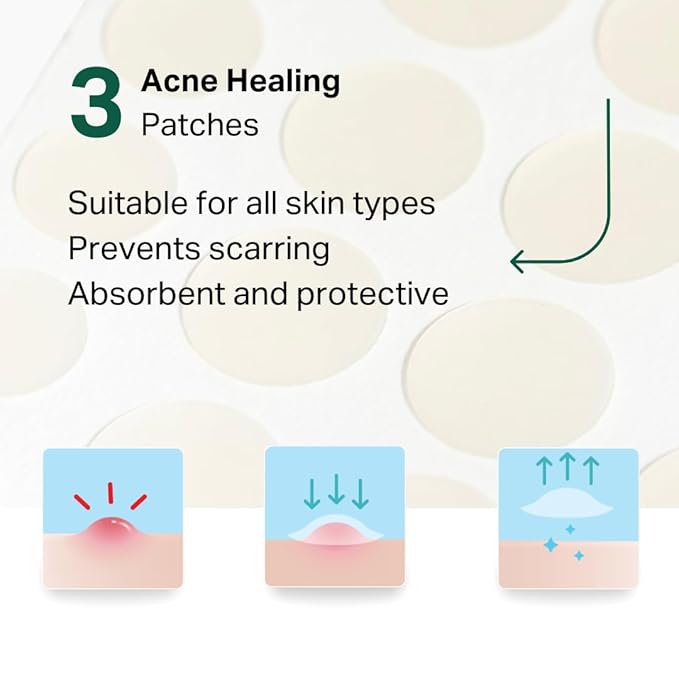 Y’OUR Essential 3-Step Acne Kit: Purifying Cleanser, Anti-Acne Serum & Healing Patches; Pimple Clearing, Pore Minimizing Skincare Routine. Made in USA. Suitable for All Skin Types