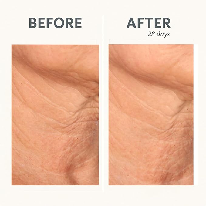 Serious Skincare Reverse Lift CORREC-CHIN IN-TENSE Firming Treatment Cream, for Tightening Double Chin, Neck, Jawline, Anti-Aging Moisturizer, Firming Skin Care 1.7 oz