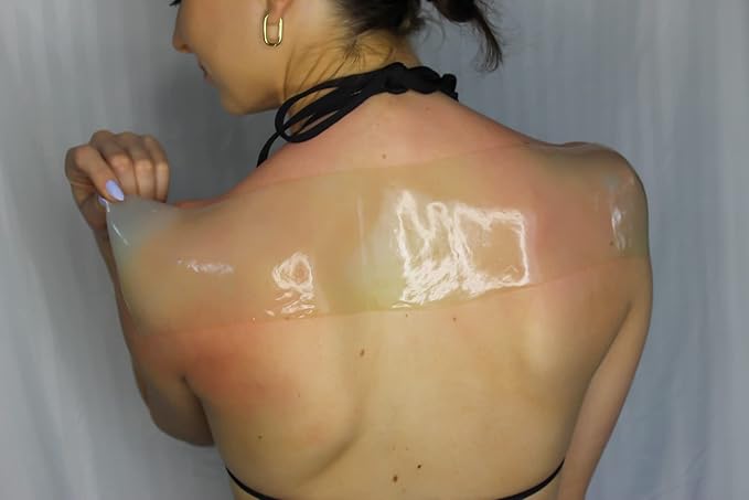 Aloe Wrap for Sunburn Relief – Hydro-Gel Aftersun Treatment with 100% pure aloe vera Gel | Second Skin aloevera gel for burns and peeling irritation | Great for Tattoo Aftercare and Sun Care