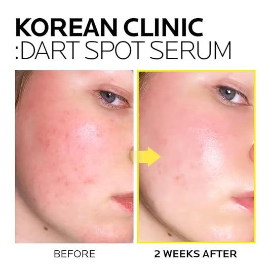 MIMUMIMU Dark Spot Remover Serum for Face | Korean Clinic Skincare - Thioctic Acid 0.01% & Niacinamide 5% | Spot Treatment for Melasma, Hyperpigmentation, Discoloration, Acne Scars | Pack of 3