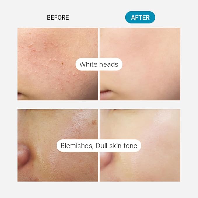 TENZERO Green Tangerine Vita C Toner Pad (70 Count, 160g), 100% Natural Cotton, Moisturizing Brightening, Korean Facial Toner Pads, Blemishes Dull Skin