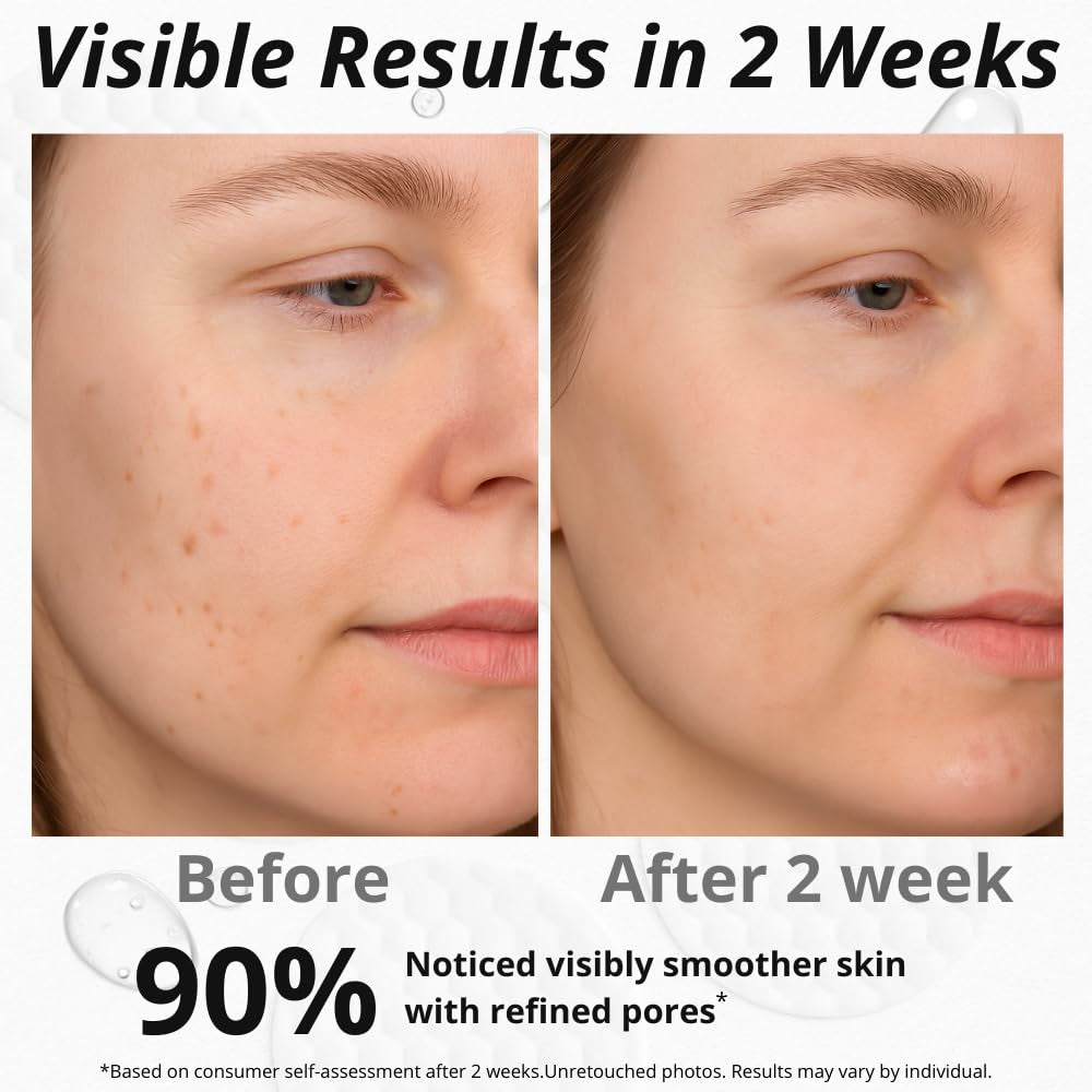 Glycolic Acid Pads for Face – Exfoliating Toner Pads with Salicylic Acid, Alpha Arbutin, Vitamin B3 B5 B8 – Daily Facial Radiance Pad for Smooth Texture, Clear & Blemish-Free Skin – 70 Count