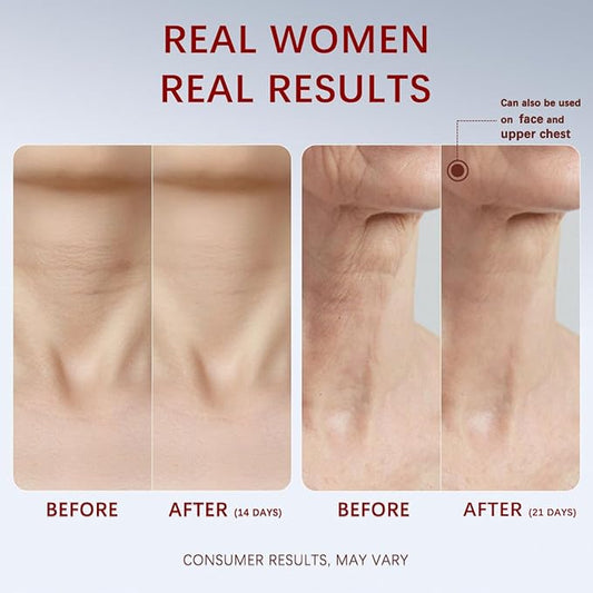 Neck Firming Cream, Anti-Aging Tightening And Lifting Treatment With Peptides, Retinol, Collagen & Hyaluronic Acid Cream For Neck, Face and Chest (1.7 Fl Oz)